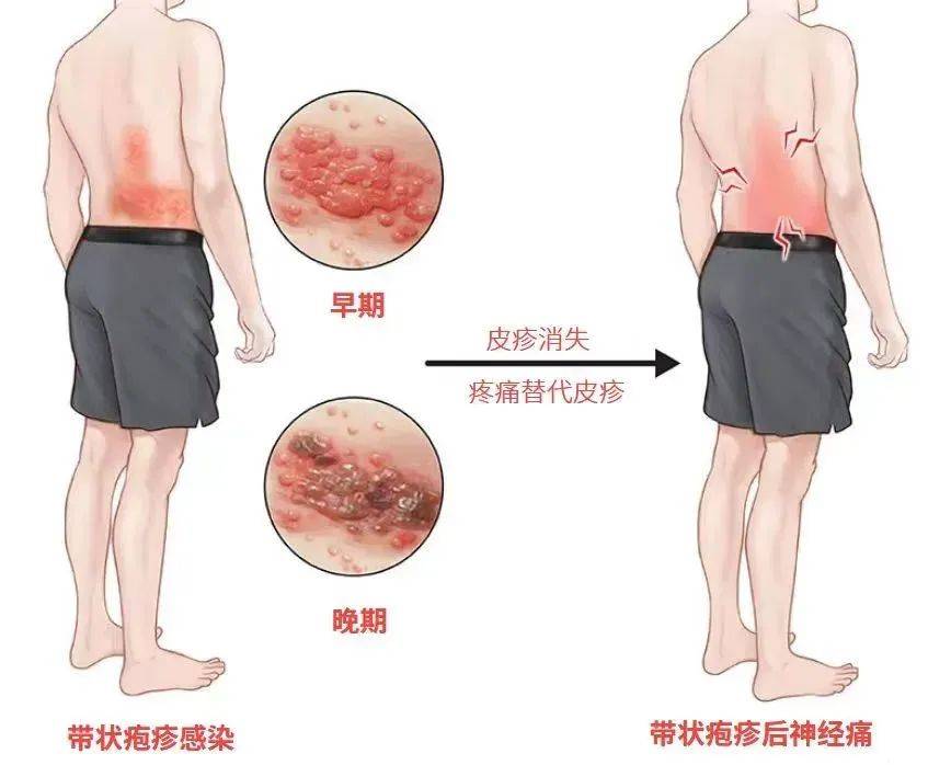 一旦感染终身携带<strong></p>
<p>币圈交易30秒看涨跌</strong>！深圳疾控提醒：这4类人要注意
