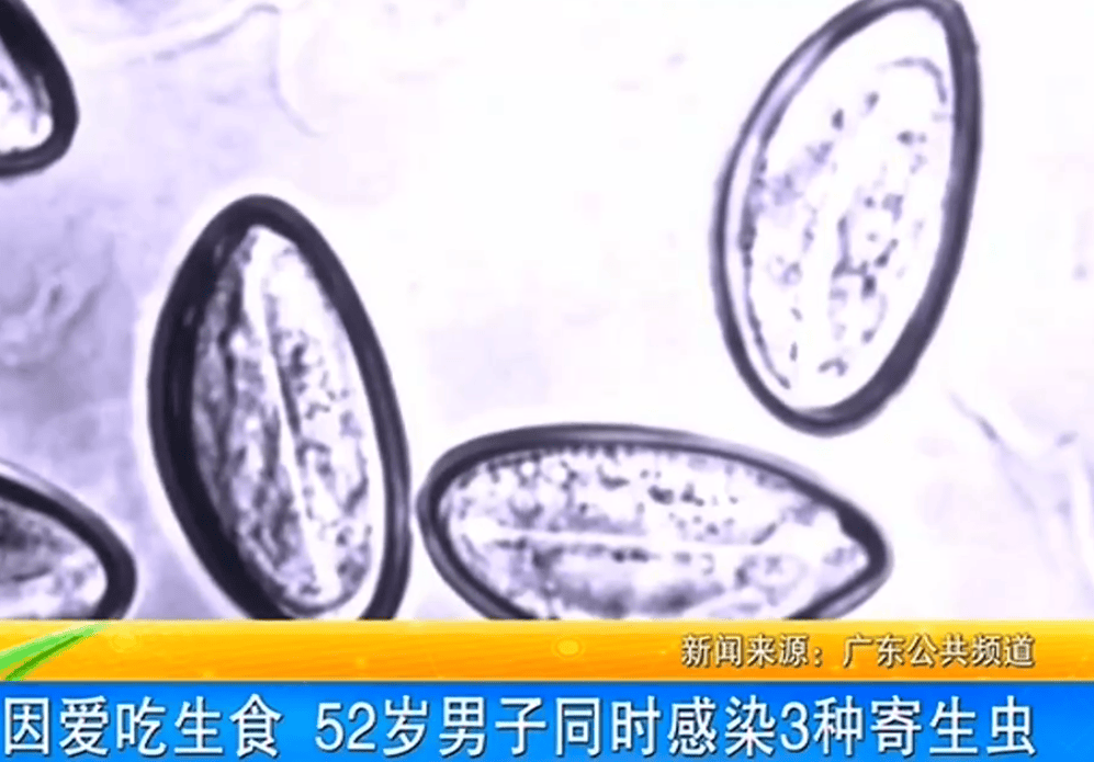 女子体内排出10米长绦虫<strong></p>
<p>波场币多少钱一个</strong>！原是两年前旅游时吃了这种食物