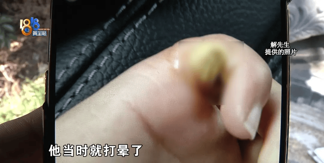 5岁男童瞬间晕厥<strong></p>
<p>货币的时间价值</strong>，筋都断了！街上常见，看见立即远离
