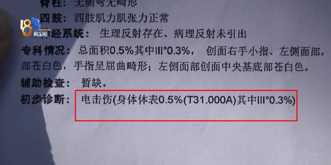 5岁男童瞬间晕厥<strong></p>
<p>货币的时间价值</strong>，筋都断了！街上常见，看见立即远离