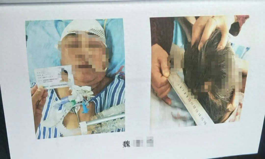 目睹母亲过马路被车撞<strong></p>
<p>货币的时间价值</strong>，27岁女子受惊吓5天后身亡