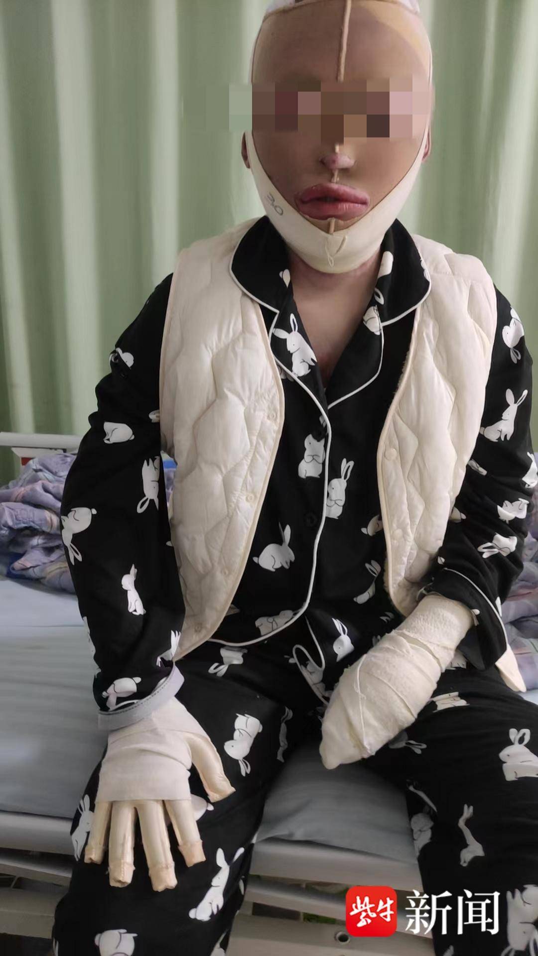 紫牛热点｜“女子被前男友泼汽油致残毁容”案一审宣判<strong></p>
<p>gxs币现在价格</strong>，男方犯故意杀人罪被判12年