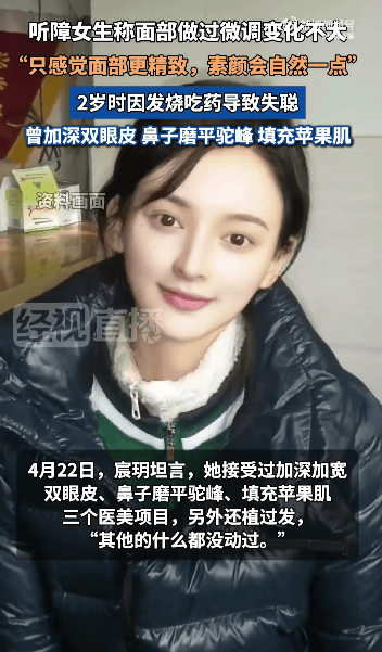 “美院聋哑女生因长相太完美”登热搜第一<strong></p>
<p>原油cl</strong>，本人承认微调：不太上镜，比照片视频好看