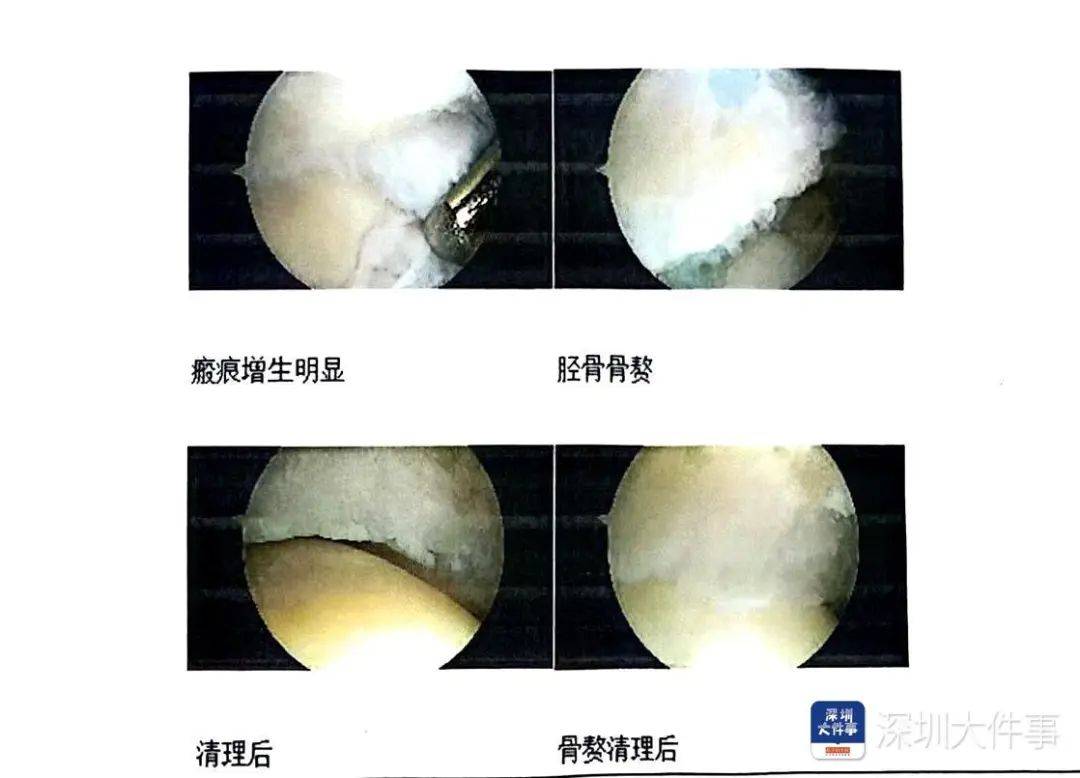 “一走路就痛”！女子脚踝受伤遭漏诊<strong></p>
<p>原油加盟</strong>，治了7年没好！深圳一医院被告上法庭