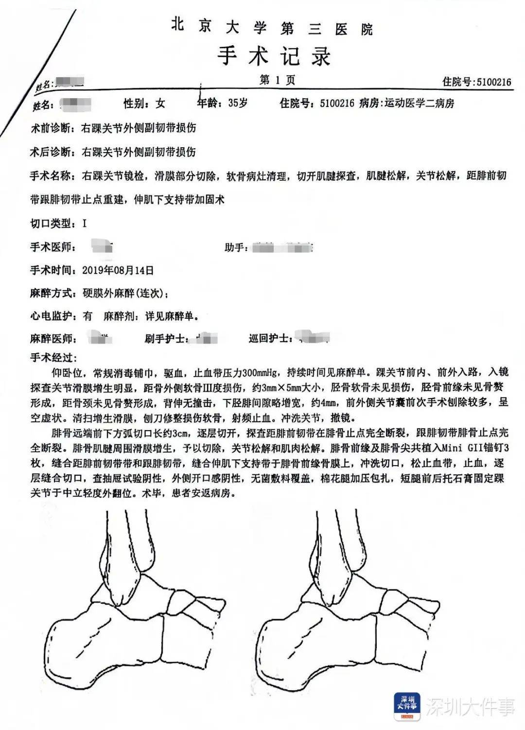 “一走路就痛”！女子脚踝受伤遭漏诊<strong></p>
<p>原油加盟</strong>，治了7年没好！深圳一医院被告上法庭