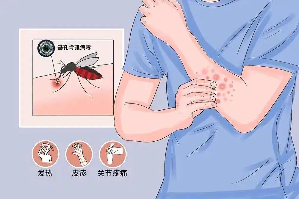 风险增大<strong></p>
<p>原油加热器</strong>！深圳疾控：去这247处要小心！张文宏首次发声