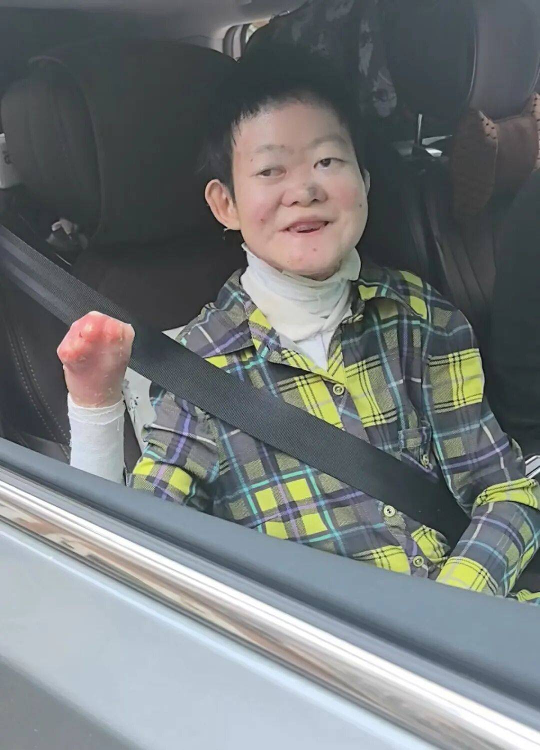 医生断言“活不过2岁”的郑州罕见病女孩<strong></p>
<p>free价格</strong>，24岁“带伤出征”，开启西藏之行