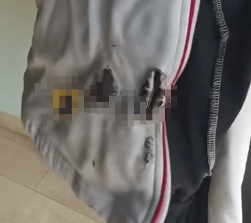 高中生散步时校服突发自燃<strong></p>
<p>传奇</strong>？原是165元网购的“宝”在惹祸→