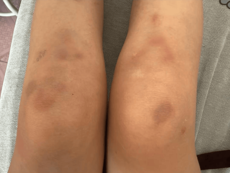 女子自称因工资问题被老板锁办公室里打 警方：双方已到派出所<strong></p>
<p>虚拟贸币</strong>，是否打人还在调查