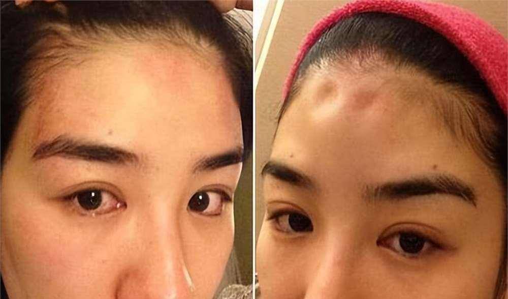 罗霖被家暴17年<strong></p>
<p>虚拟贸币</strong>，蓝洁瑛遭性侵暴力还被围观！女明星的暴力事件还有很多