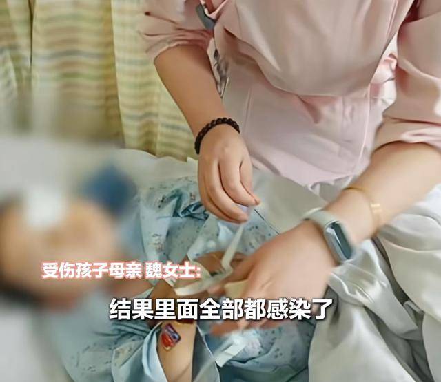 江西一5岁男孩在幼儿园被戳伤致左眼失明<strong></p>
<p>虚拟币挖矿</strong>，家长称老师用猪油涂抹试图消肿