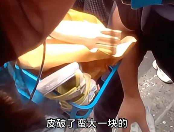 看着都疼<strong></p>
<p>虚拟币黄白线</strong>！上海街头一男子突然求助：10岁女儿被死死卡住！这个行为太危险→