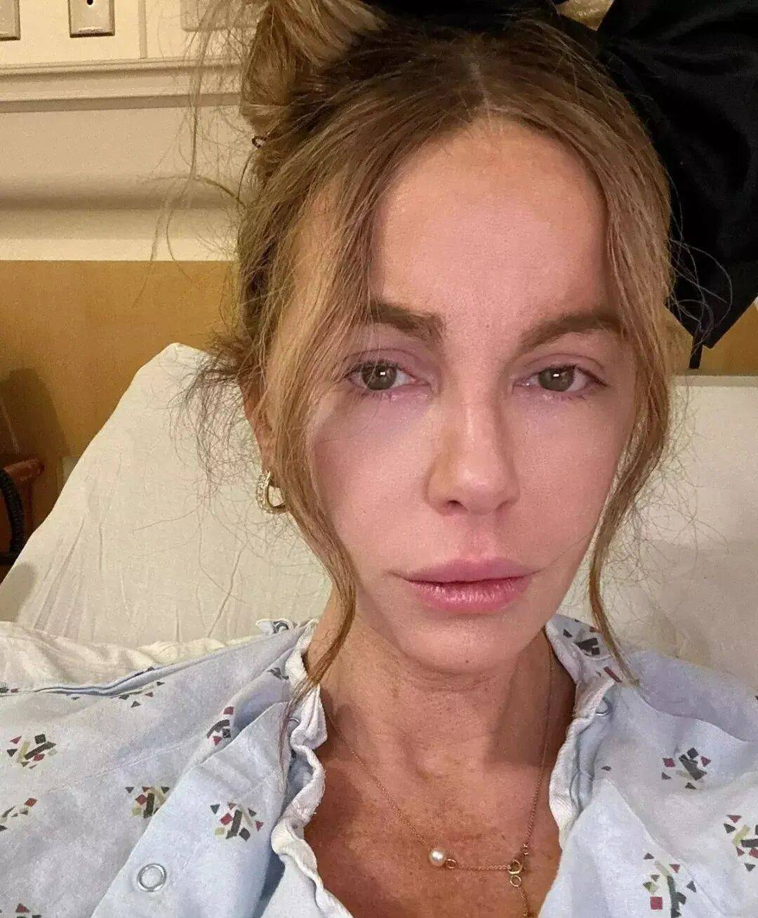 最美吸血鬼如今瘦成骷髅<strong></p>
<p>株洲虚拟币案件</strong>？《珍珠港》女主究竟怎么了？